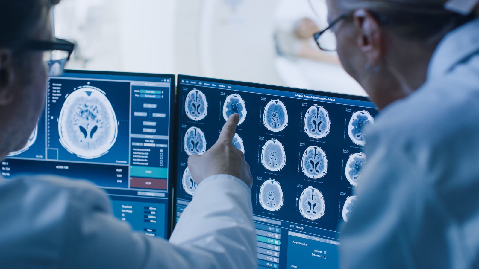 stock image of doctors examining brain scans